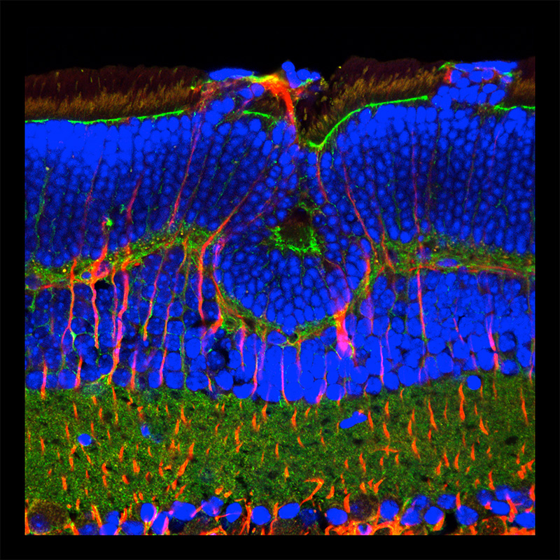 Andrea Rassell micrographs made using confocal microscopy image